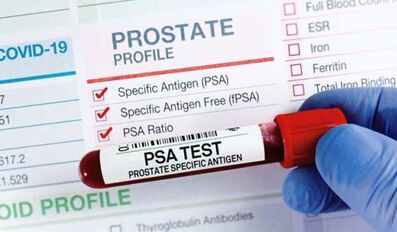  advanced prostate cancer symptoms